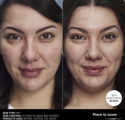 The INKEY List Retinol Anti-Aging Serum - Imagen 4