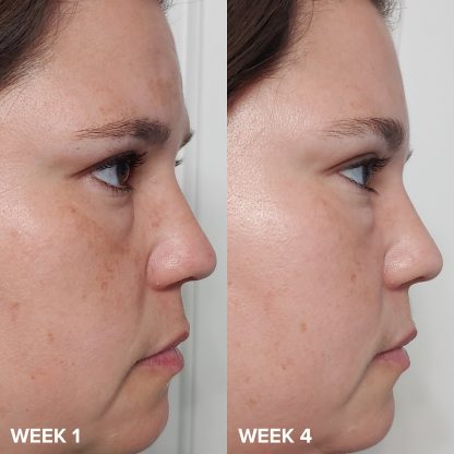 Paula's Choice Skin Perfecting 2% BHA Liquid Exfoliant - Imagen 3