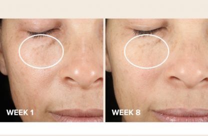 Paula's Choice CLINICAL Discoloration Repair Serum - Imagen 6
