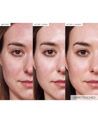 Glow Recipe Avocado Ceramide Redness Relief Serum - Imagen 5
