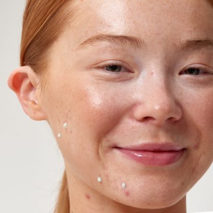 The INKEY List Succinic Acid Acne Treatment - Imagen 3