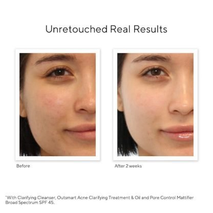 Murad Oil and Pore Control Mattifier Broad Spectrum SPF 45 PA++++50ml - Imagen 5