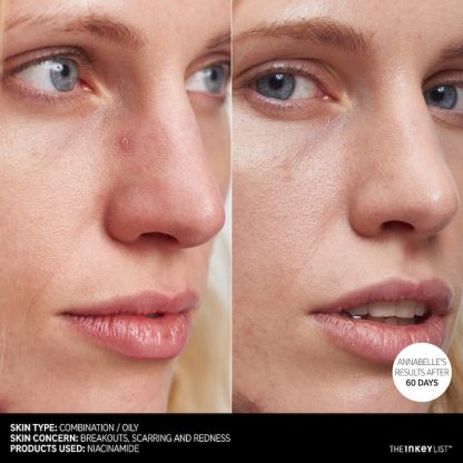 The INKEY List Niacinamide Oil Control Serum - Imagen 6