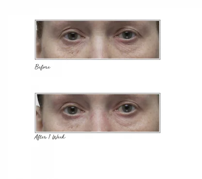 Tatcha AGELESS REVITALIZING EYE CREAM Revitalizing Eye Cream - Imagen 3