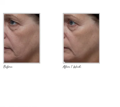 Tatcha AGELESS REVITALIZING EYE CREAM Revitalizing Eye Cream - Imagen 2