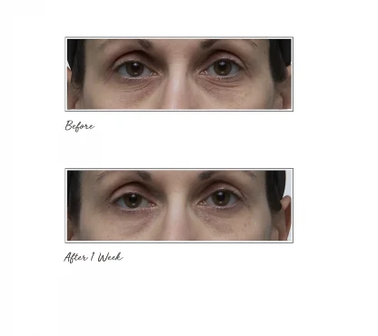 Tatcha AGELESS REVITALIZING EYE CREAM Revitalizing Eye Cream - Imagen 4