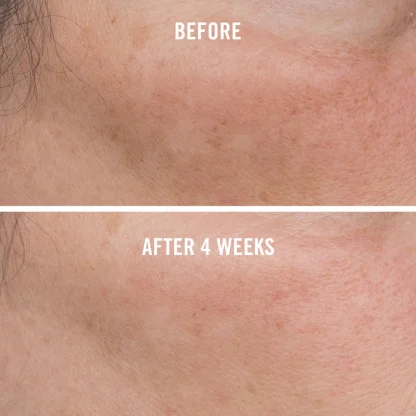 First Aid Beauty Facial Radiance Niacinamide Dark Spot Serum 30ml - Imagen 5