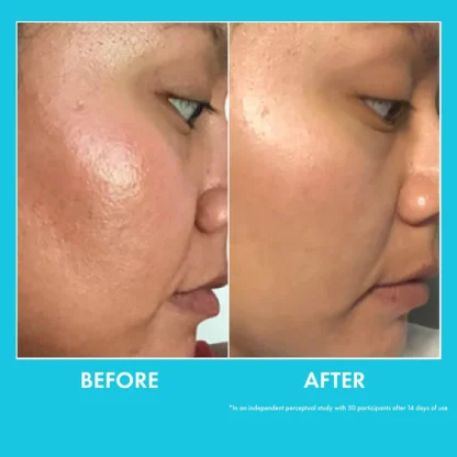 KOPARI MOISTURE WHIPPED CERAMIDE CREAM - Imagen 4