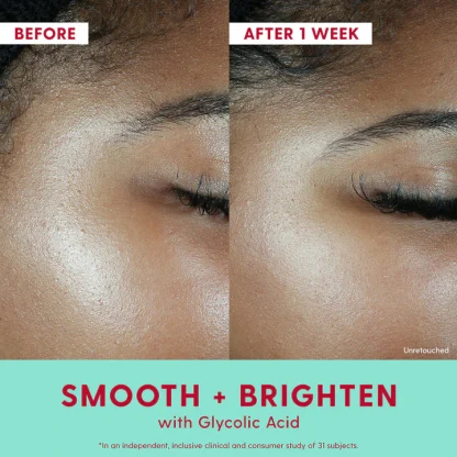 Kinship Self Smooth 10% Glycolic Resurfacing Serum - Imagen 2