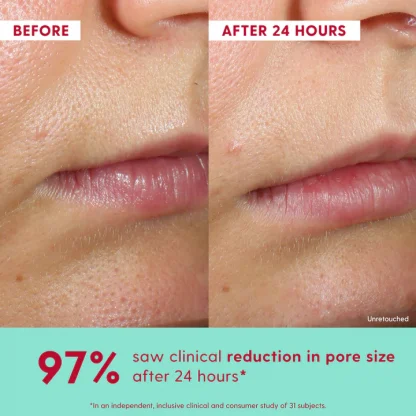 Kinship Self Smooth 10% Glycolic Resurfacing Serum - Imagen 3