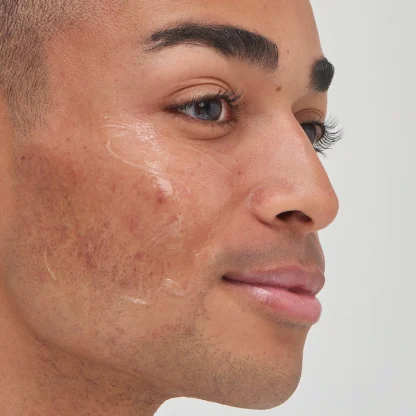 The INKEY List Tranexamic Acid Hyperpigmentation Treatment - Imagen 3