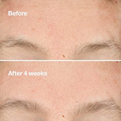 CLINIQUE Clarifying Do-Over Peel - Imagen 2