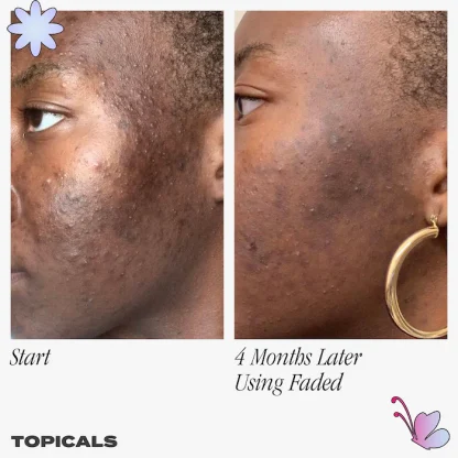 Topicals Faded Serum for Dark Spots & Discoloration - Imagen 5
