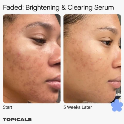 Topicals Faded Serum for Dark Spots & Discoloration - Imagen 2