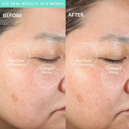 PMD BEAUTY  pmd clean smart facial cleansing device - Imagen 8
