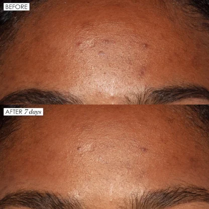 Sunday Riley Good Genes All-In-One AHA Lactic Acid Treatment - Imagen 4
