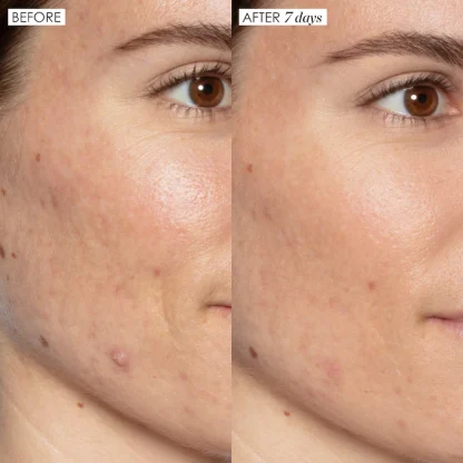 Sunday Riley Good Genes All-In-One AHA Lactic Acid Treatment - Imagen 5