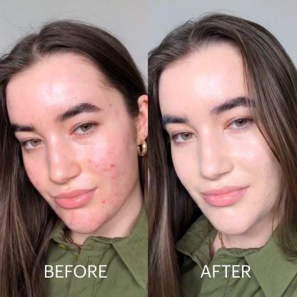 Dr. Jart+ Cicapair™ Tiger Grass Color Correcting Treatment SPF 30 - Imagen 5