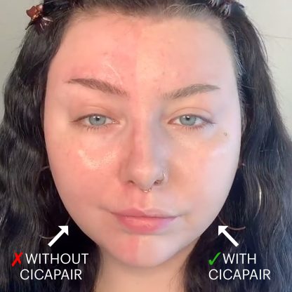 Dr. Jart+ Cicapair™ Tiger Grass Color Correcting Treatment SPF 30 - Imagen 4