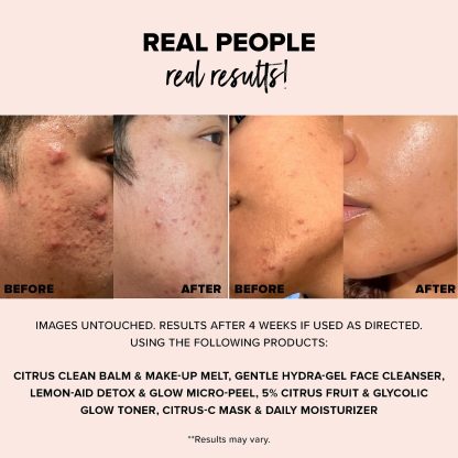 NUDESTIX NUDESKIN Citrus-C Mask & Daily Moisturizer - Imagen 4