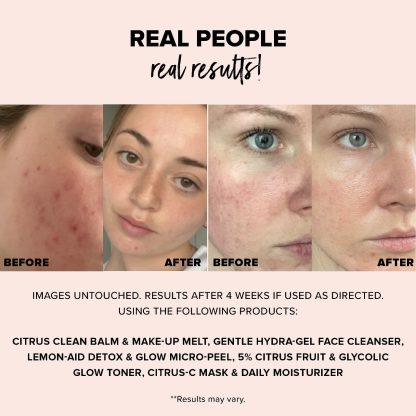 NUDESTIX NUDESKIN Citrus-C Mask & Daily Moisturizer - Imagen 5