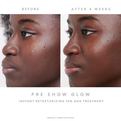 Fenty Skin Pre-Show Glow Refillable Instant Retexturizing 10% AHA Treatment - Imagen 3