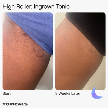 Topicals High Roller Ingrown Hair Tonic with AHA and BHA - Imagen 6
