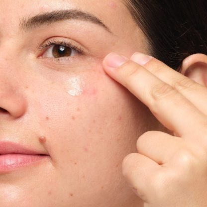 The Ordinary Multi-Peptide Eye Serum - Imagen 2