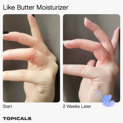 Topicals Like Butter Moisturizer for Dry, Sensitive & Eczema-Prone Skin - Imagen 4