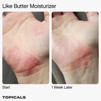 Topicals Like Butter Moisturizer for Dry, Sensitive & Eczema-Prone Skin - Imagen 7