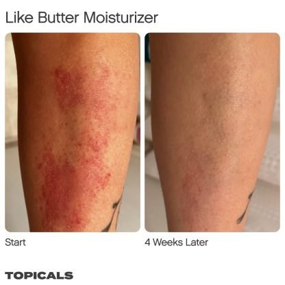 Topicals Like Butter Moisturizer for Dry, Sensitive & Eczema-Prone Skin - Imagen 6