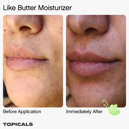 Topicals Like Butter Moisturizer for Dry, Sensitive & Eczema-Prone Skin - Imagen 5