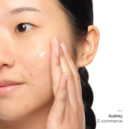 The Ordinary Aloe 2% + NAG 2% Solution - Imagen 2