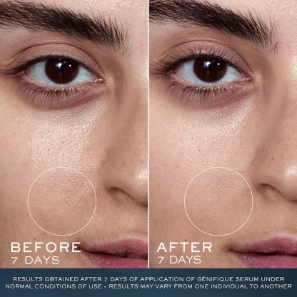 Lancôme Advanced Génifique Radiance Boosting Face Serum - Imagen 2