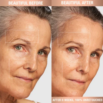 Charlotte Tilbury Magic Cream Moisturizer with Hyaluronic Acid - Imagen 6