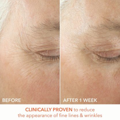 Dr. Dennis Gross Skincare Mini Alpha Beta® x 3 - Imagen 4