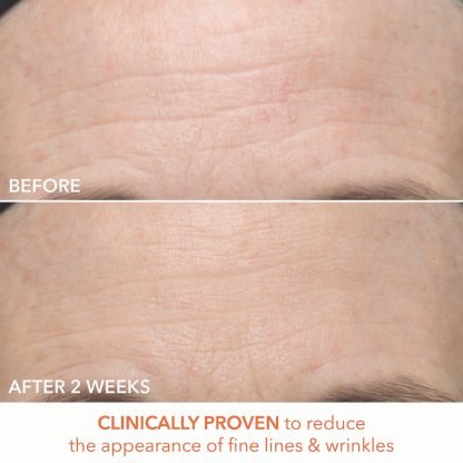 Dr. Dennis Gross Skincare Mini Alpha Beta® x 3 - Imagen 3