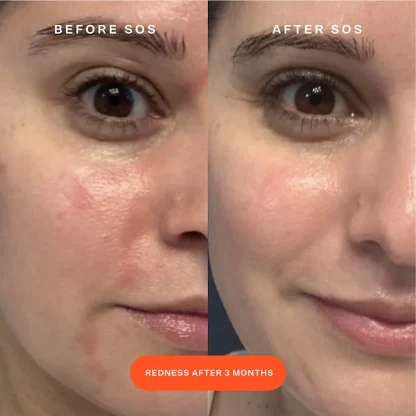 Tower 28 Beauty SOS Daily Rescue Facial Spray - Imagen 3