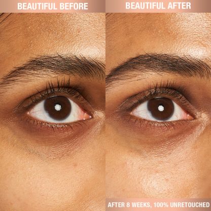 Charlotte Tilbury Charlotte’s Magic Eye Cream with Retinol - Imagen 6