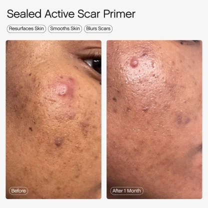 Topicals Sealed Active Scar Filling Primer for Acne Prone Skin 28ml - Imagen 5
