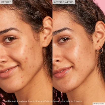 Glow Recipe Strawberry Smooth BHA + AHA Salicylic Acid Serum - Imagen 3