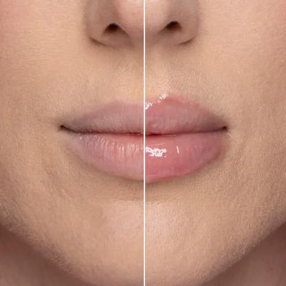 Too Faced Lip Injection Extreme Hydrating Lip Plumper full size - Imagen 5