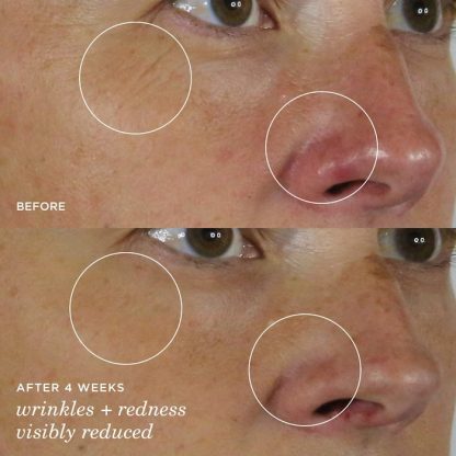 Tatcha The Silk Serum Wrinkle-Smoothing Retinol Alternative - Imagen 3