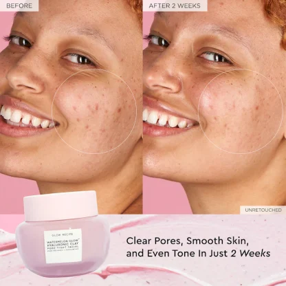 Glow Recipe Watermelon Glow Hyaluronic Clay Pore-Tight Facial Mask 60ml - Imagen 3
