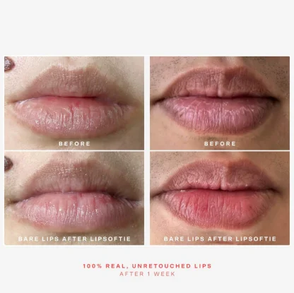 Tower 28 Beauty LipSoftie™ Hydrating Tinted Lip Treatment Balm - Imagen 5