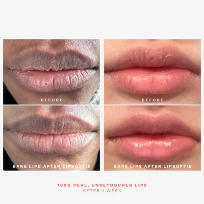 Tower 28 Beauty LipSoftie™ Hydrating Tinted Lip Treatment Balm - Imagen 7
