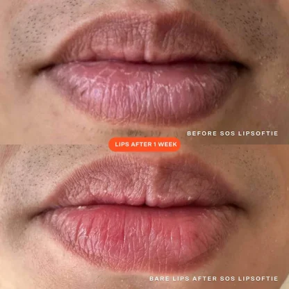 Tower 28 Beauty LipSoftie™ Hydrating Tinted Lip Treatment Balm - Imagen 4