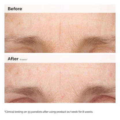 The Ordinary Retinal 0.2% Emulsion Serum - Imagen 4