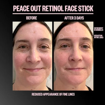 Peace Out Retinol Face Stick - Imagen 5