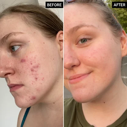 The Inkey List Glycolic Acid Toner (CAJA AVERIADA) - Imagen 3